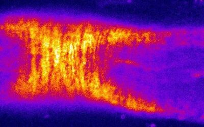 Le rôle des ondes électriques de l’intestin sur la différentiation du muscle