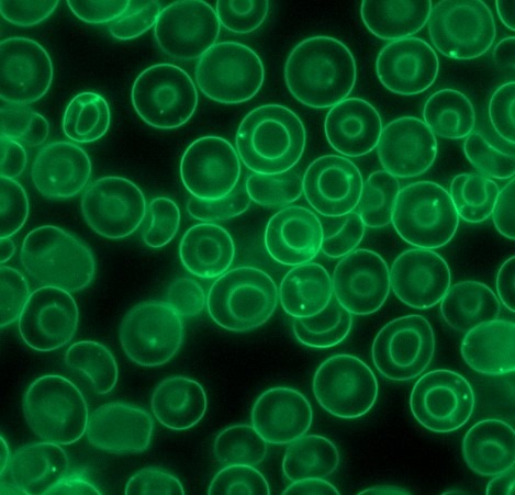 Using molecular rotors to investigate hemoglobin concentration and heterogeneity in red blood cells