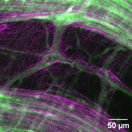 Un second cerveau particulièrement costaud