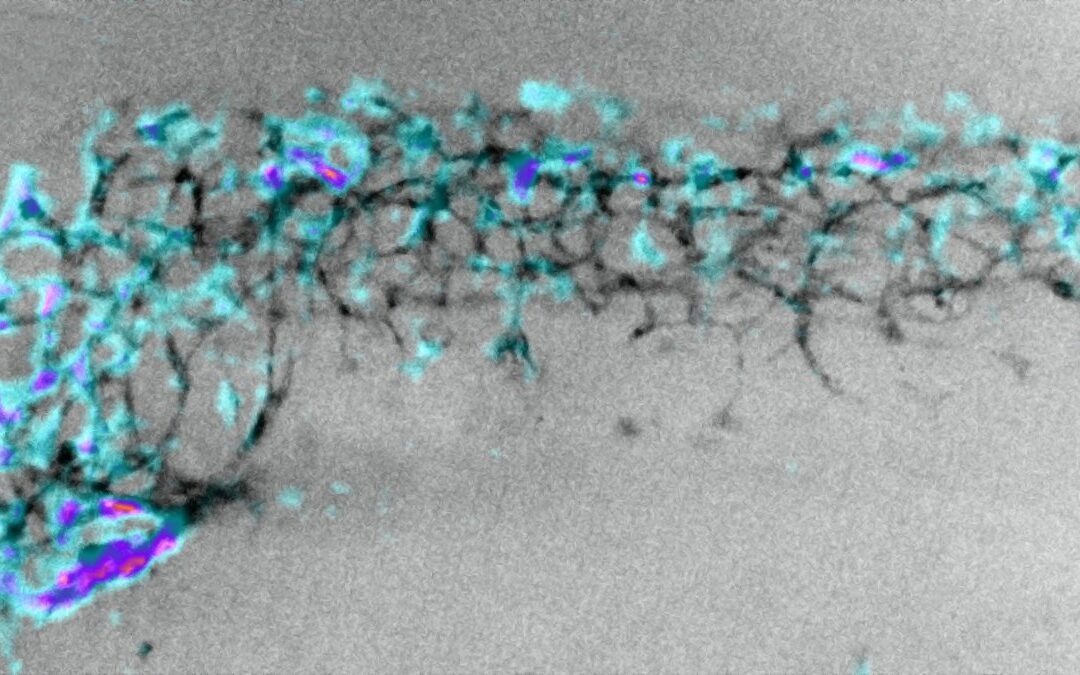 Les cellules de la crête neurale : de minuscules « muscles électriques » à la conquête de l’embryon