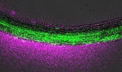 Face à la rigidification des sols, les racines développent une capacité d’auto-adaptation inédite
